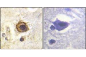 Immunohistochemistry analysis of paraffin-embedded human brain tissue, using PDGFR beta (Ab-1021) Antibody. (PDGFRB antibody  (AA 991-1040))