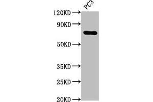 Western Blot Positive WB detected in: PC3 whole cell lysate All lanes: TP63 antibody at 2. (Recombinant p63 antibody)