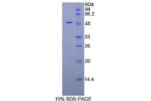 SDS-PAGE analysis of Human alpha Galactosidase Protein.