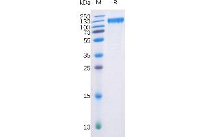 SDS-PAGE (SDS) image for Fms-Related tyrosine Kinase 3 (FLT3) (AA 27-543) protein (Fc-His Tag) (ABIN6961080)