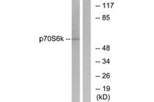 Western blot analysis of extracts from HeLa cells, treated with Insulin 10mU/ml 5', using p70 S6 Kinase (Ab-411) Antibody. (RPS6KB1 antibody  (AA 401-450))