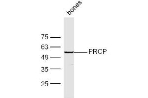 Mouse Bone lysates probed with PRCP Polyclonal Antibody, Unconjugated  at 1:300 dilution and 4˚C overnight incubation.