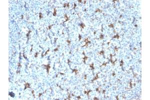 Immunohistochemistry (IHC) image for anti-CD68 Molecule (CD68) antibody (ABIN6941238)