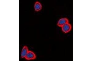 Immunofluorescent analysis of EGFR staining in MCF cells.