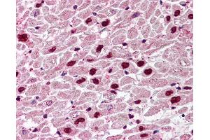 Anti-UNG antibody IHC of human heart.