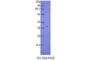 SDS-PAGE (SDS) image for Cathepsin C (CTSC) (AA 231-462) protein (His tag) (ABIN2120771)