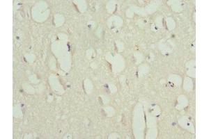Immunohistochemistry of paraffin-embedded human brain tissue using ABIN7144140 at dilution of 1:100 (Anillin antibody  (AA 845-1124))
