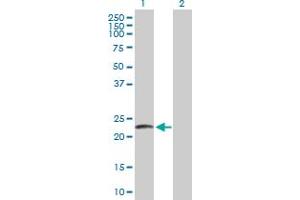 Western Blot analysis of LYZL2 expression in transfected 293T cell line by LYZL2 MaxPab polyclonal antibody. (Lysozyme-Like 2 antibody  (AA 1-194))