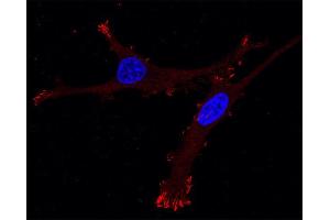 Immunocytochemistry (ICC) image for anti-Zyxin (ZYX) (AA 352-357) antibody (ABIN1742558) (ZYX antibody  (AA 352-357))