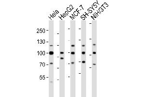 Western blot analysis of lysates from Hela, HepG2, MCF-7, SH-SY5Y, mouse NIH/3T3 cell line (from left to right), using FGFR1 Antibody (Center) (ABIN6243223 and ABIN6577702). (FGFR1 antibody  (AA 291-324))