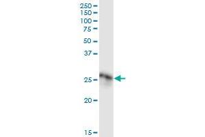 Immunoprecipitation of C1QA transfected lysate using anti-C1QA MaxPab rabbit polyclonal antibody and Protein A Magnetic Bead , and immunoblotted with . (C1QA antibody  (AA 1-245))