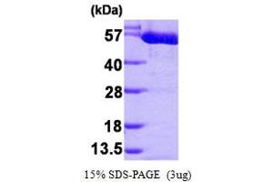 SDS-PAGE (SDS) image for Pyruvate Kinase M2 (PKM2) (AA 1-531) protein (His tag) (ABIN666913) (PKM2 Protein (AA 1-531) (His tag))