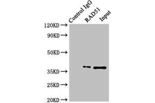 RAD51 antibody  (AA 1-228)