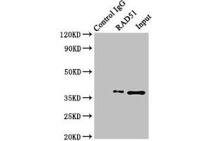 Immunoprecipitating RAD51 in K562 whole cell lysate Lane 1: Rabbit control IgG (1 μg) instead of ABIN7150287 in K562 whole cell lysate. (RAD51 antibody  (AA 1-228))