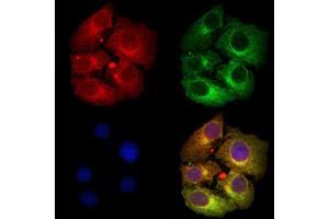 ABIN6256897 and ABIN6274326 staining Hela cells by IF/ICC.