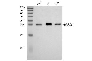 Western blot analysis of SNAP23 using anti-SNAP23 antibody (ABIN7599089). (SNAP23 antibody  (AA 1-211))