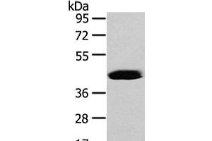 Western Blot analysis of Hela cell using VASH2 Polyclonal Antibody at dilution of 1/450