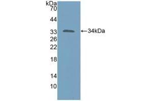 Detection of Recombinant KATNA1, Human using Polyclonal Antibody to Katanin P60 Subunit A 1 (KATNA1) (KATNA1 antibody  (AA 8-229))