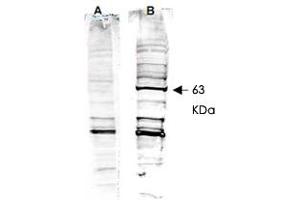 Western blot analysis is shown using RAD52 polyclonal antibody  to detect human RAD52 present in a HeLa nuclear extract (panel B). (RAD52 antibody  (AA 360-375))