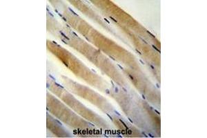 PRKAA2 (Thr172) antibody (Center) immunohistochemistry analysis in formalin fixed and paraffin embedded human skeletal muscle followed by peroxidase conjugation of the secondary antibody and DAB staining. (PRKAA2 antibody  (Middle Region, Thr172))