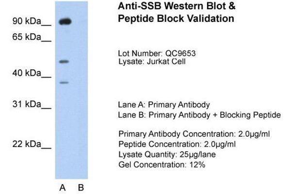 SSB antibody  (N-Term)