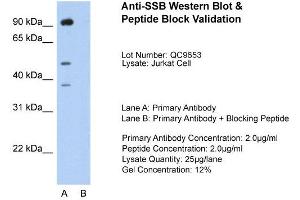 Host:  Rabbit  Target Name:  SSB  Sample Type:  Jurkat  Lane A:  Primary Antibody  Lane B:  Primary Antibody + Blocking Peptide  Primary Antibody Concentration:  2. (SSB antibody  (N-Term))