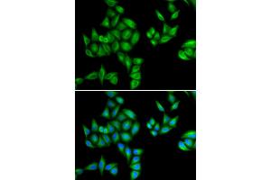 Immunofluorescence analysis of HeLa cells using BTG1 antibody (ABIN5973768). (BTG1 antibody)