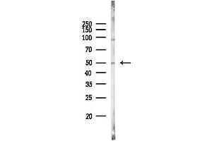 anti-Unc-51-Like Kinase 3 (ULK3) (Internal Region) antibody
