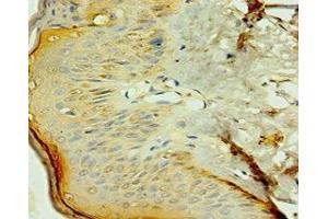 Immunohistochemistry of paraffin-embedded human skin tissue using ABIN7161904 at dilution of 1:100 (TR4 antibody  (AA 240-380))