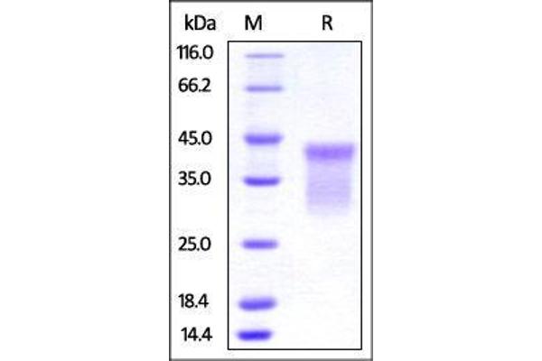 HVEM Protein (AA 39-202) (His tag)