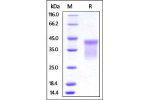 HVEM Protein (AA 39-202) (His tag)