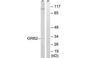 Western blot analysis of extracts from Jurkat cells, using GRB2 Antibody. (GRB2 antibody  (AA 141-190))