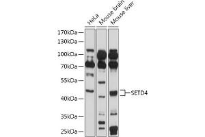 Western blot analysis of extracts of various cell lines, using SETD4 antibody (ABIN7270264) at 1:1000 dilution. (SETD4 antibody  (AA 210-300))
