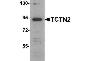 Western blot analysis of TCTN2 in SK-N-SH cell lysate with TCTN2 antibody at 1 µg/mL.
