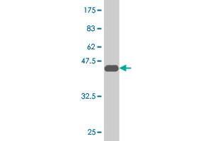 Western Blot detection against Immunogen (40. (Msx2/Hox8 antibody  (AA 1-133))