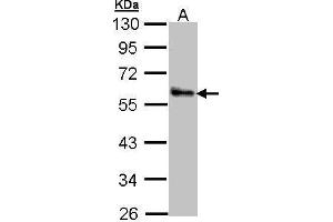 WB Image Sample (30 ug of whole cell lysate) A: A431 , 10% SDS PAGE antibody diluted at 1:1000 (ZNF259 antibody  (Center))