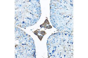 Immunohistochemistry of paraffin-embedded mouse testis using IDS Rabbit pAb (ABIN3015633, ABIN3015634, ABIN3015635 and ABIN6218988) at dilution of 1:200 (40x lens).