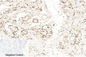 Immunohistochemical analysis of paraffin-embedded human breast tissue. (Caspase 7 antibody  (AA 160-240))