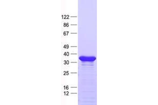 ZNF705D Protein (His tag)