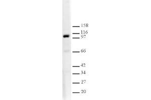L3MBTL1 antibody tested by Western blot. (L3MBTL1 antibody  (AA 1-215))