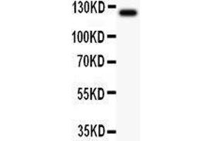 Anti-TIE2 Picoband antibody,  All lanes: Anti TIE2  at 0. (TEK antibody  (AA 641-830))