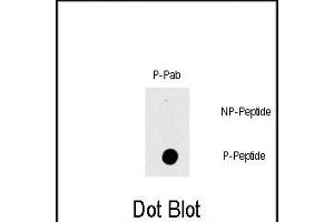 Dot blot analysis of Phospho-RAF1- polyclonal antibody (ABIN389743 and ABIN2839676) on nitrocellulose membrane. (RAF1 antibody  (pThr269))