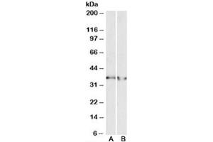 Western blot testing of human heart [A] and human kidney [B] lysates with LDHB antibody at 0. (LDHB antibody)