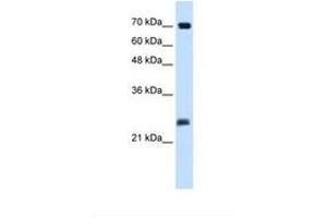 Image no. 2 for anti-SERTA Domain Containing 1 (SERTAD1) (N-Term) antibody (ABIN324352)