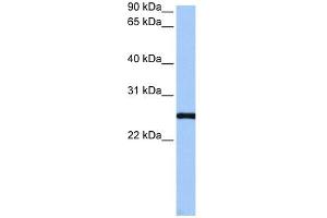 CCDC46 antibody used at 1 ug/ml to detect target protein. (CCDC46 antibody  (C-Term))