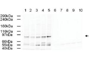 Western blot using AP2A1 polyclonal antibody  shows detection of a band just below 100 KDa correspond-ing to Human AP2A1 in a various preparations. (alpha Adaptin antibody  (AA 3-14))