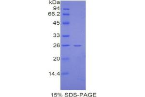 SDS-PAGE analysis of Mouse CREB Binding Protein. (CBP Protein)