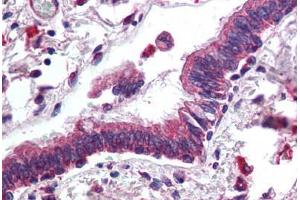 Human Lung, Respiratory Epithelium (formalin-fixed, paraffin-embedded) stained with ERBB3 antibody ABIN305733 at 5 ug/ml followed by biotinylated anti-goat IgG secondary antibody ABIN481715, alkaline phosphatase-streptavidin and chromogen. (ERBB3 antibody  (AA 1330-1342))