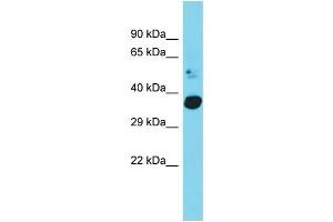 Host: Rabbit Target Name: C20orf72 Sample Type: Fetal Heart lysates Antibody Dilution: 1. (C20orf72 antibody  (C-Term))