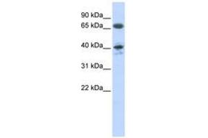 Image no. 1 for anti-Angiotensin II Receptor, Type 1 (AGTR1) (AA 37-86) antibody (ABIN6740751) (Angiotensin II Type-1 Receptor antibody  (AA 37-86))